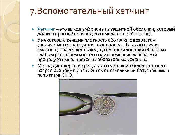 Метод экстракорпорального оплодотворения (эко), его история и развитие.
