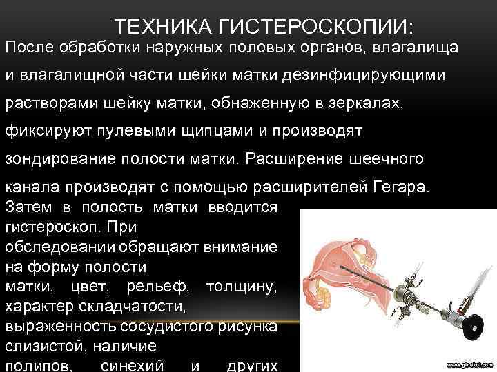 Гистероскопия матки презентация