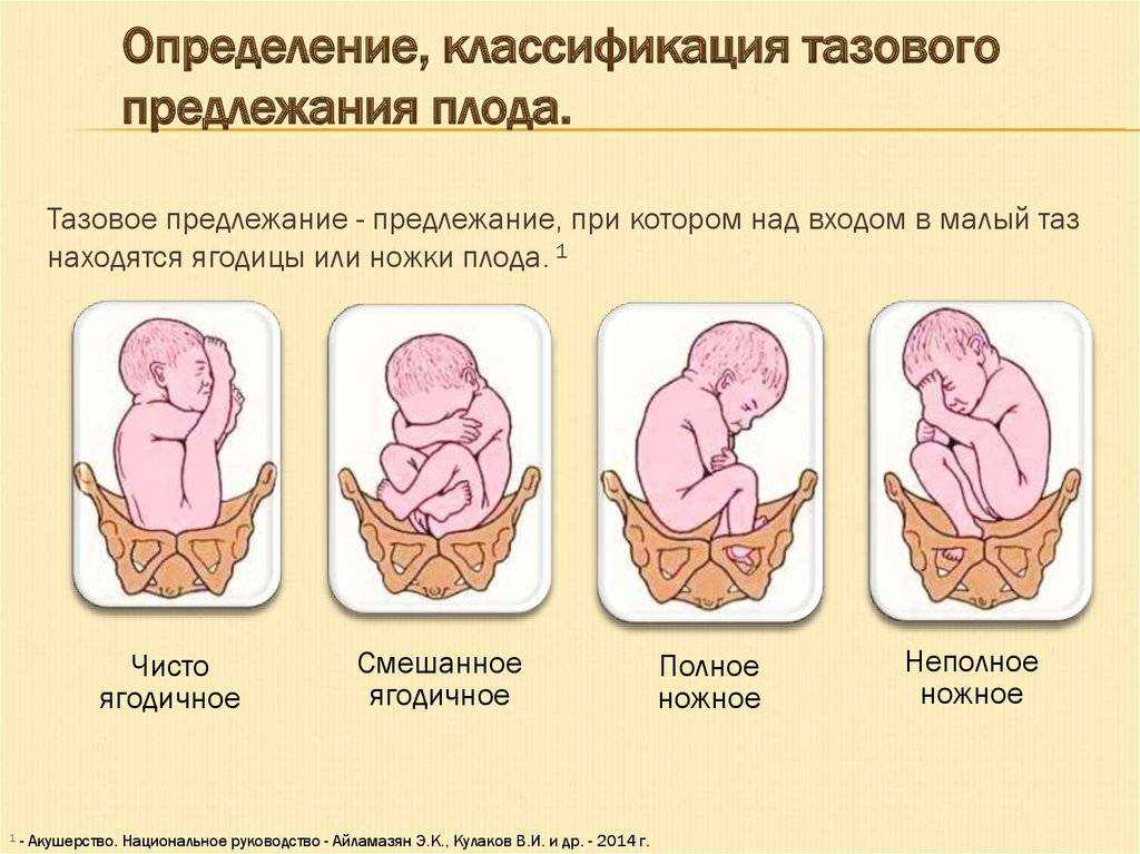 Расшифровка гинекологического узи | университетская клиника