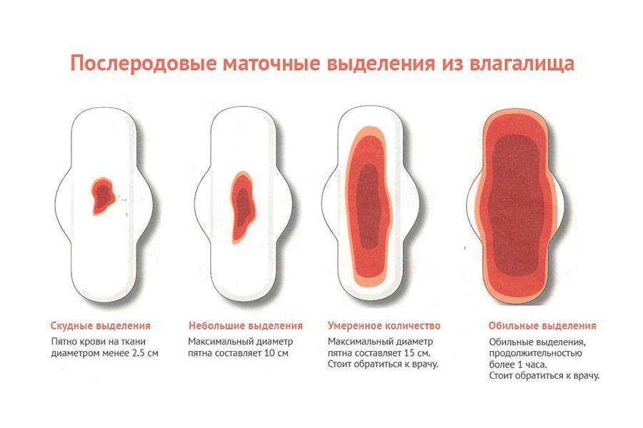 Обильность месячных по дням картинка