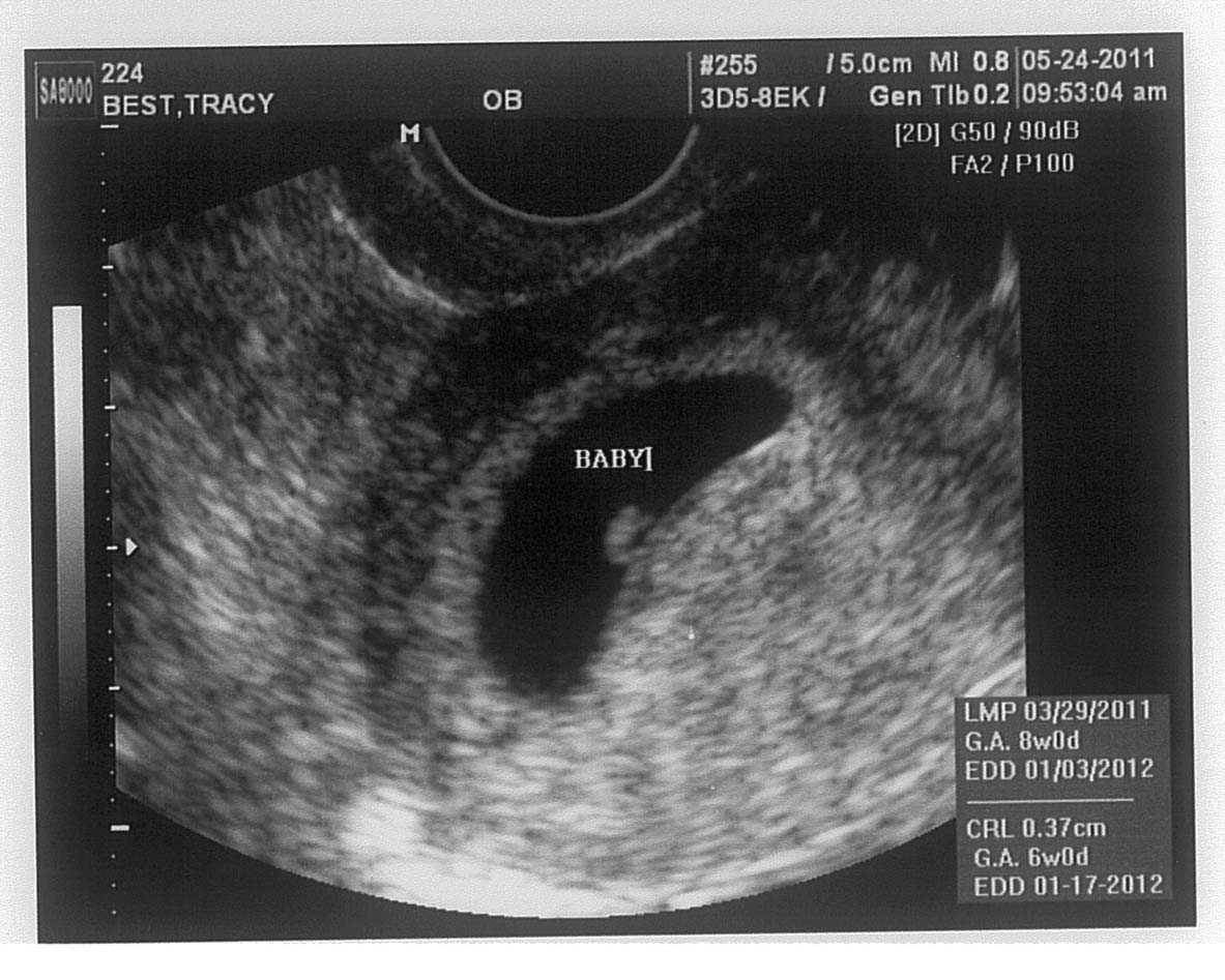 6 недель от зачатия