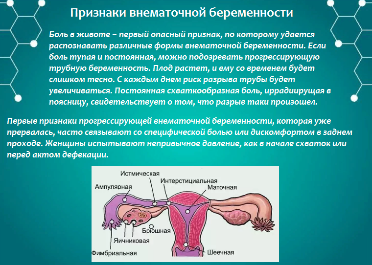 Внематочная беременность. причины, симптомы, диагностика и лечение :: polismed.com