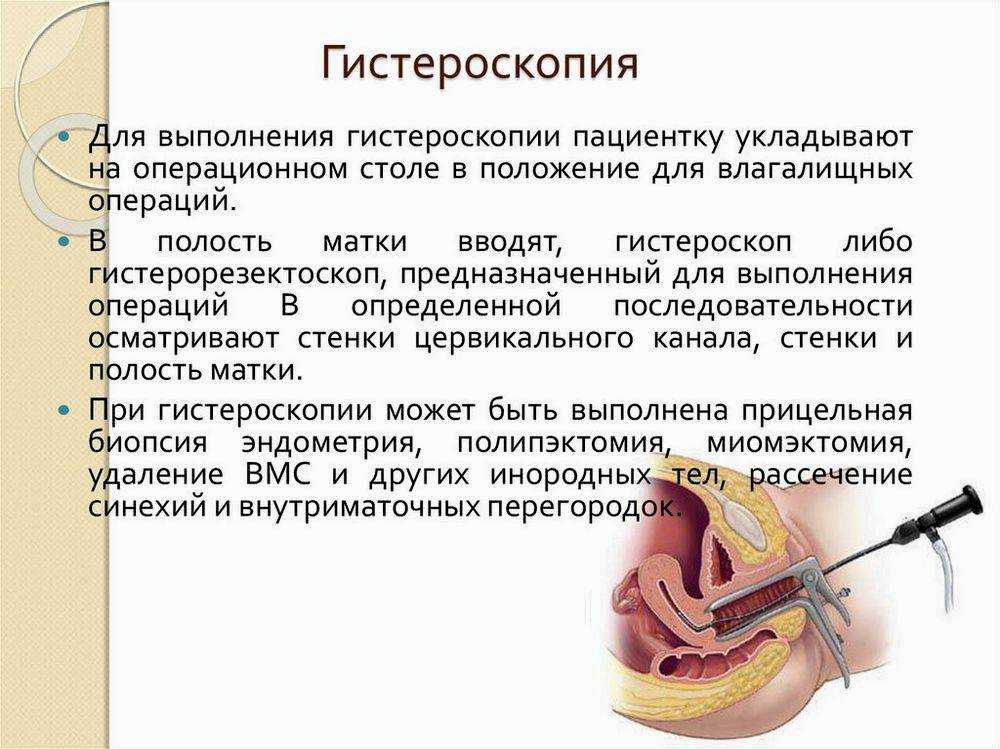 Гистероскопия матки презентация