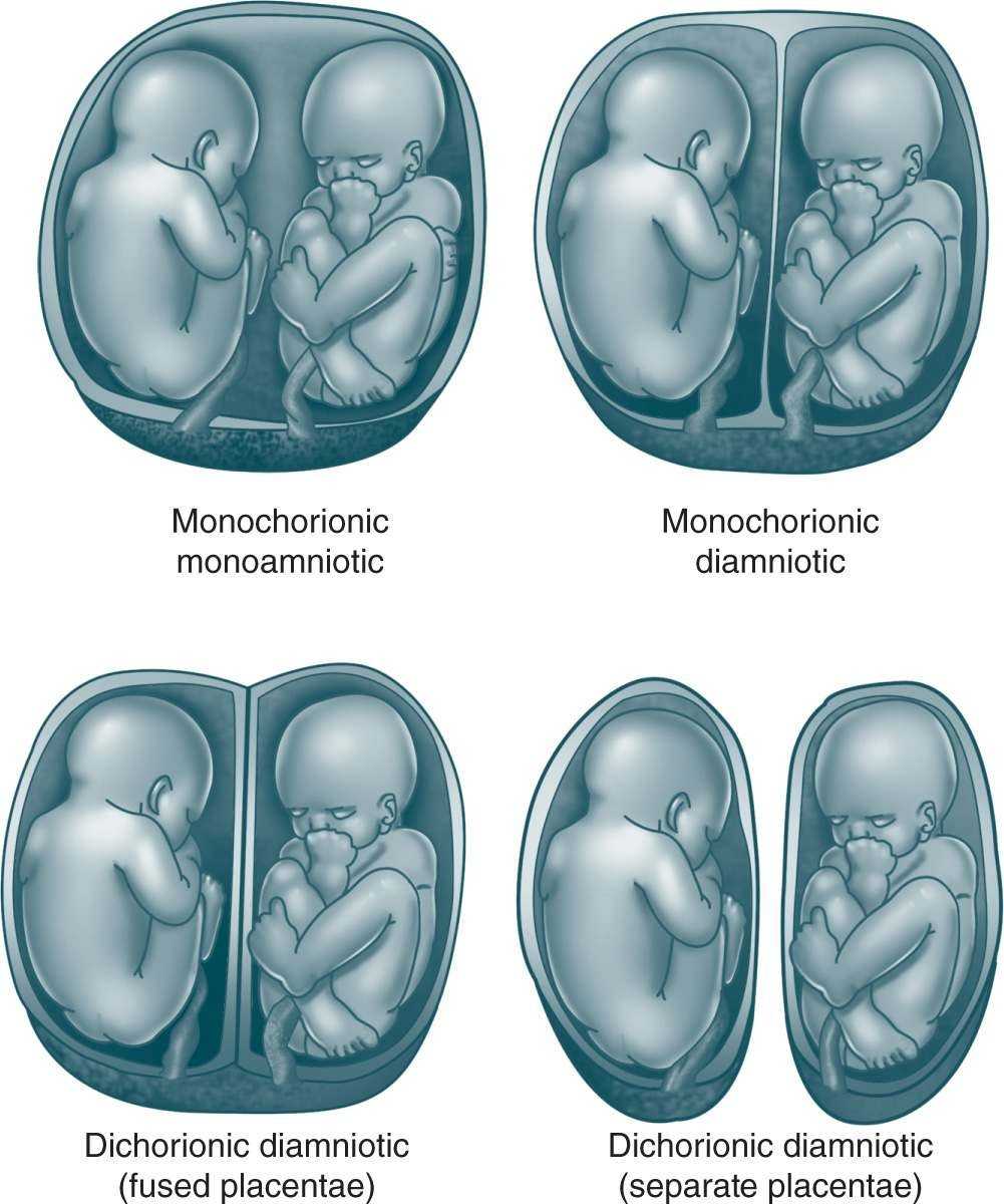 Месячные на ранних сроках беременности: норма или угроза? • центр гинекологии в санкт-петербурге
