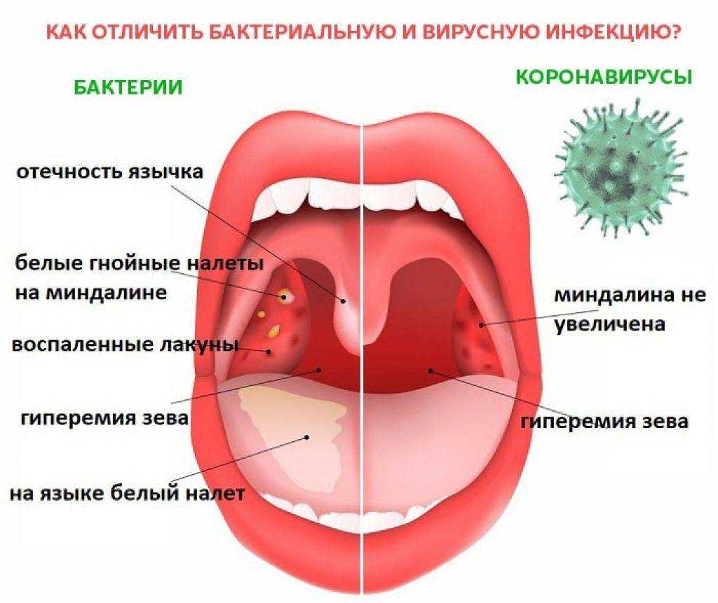Орфанные заболевания и связанные с ними проблемы | шашель | медицинский вестник юга россии