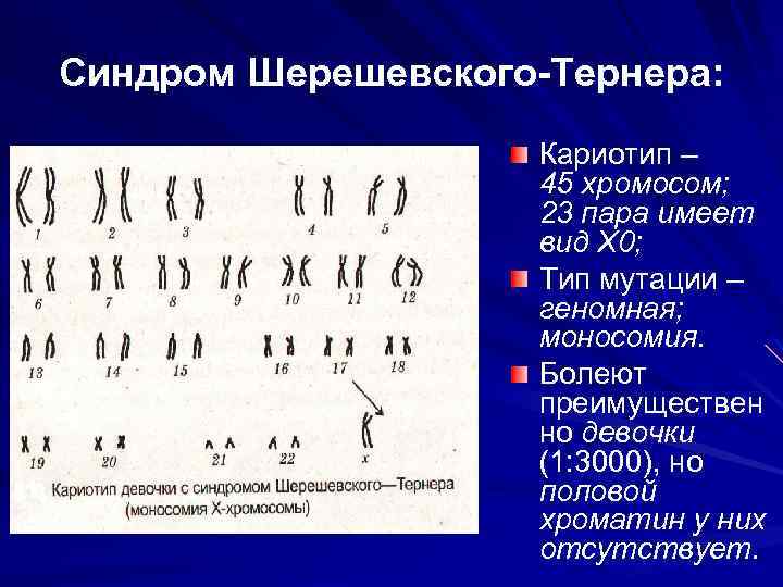 Моносомия х, синдромом шерешевского-тернера, нужное лечение