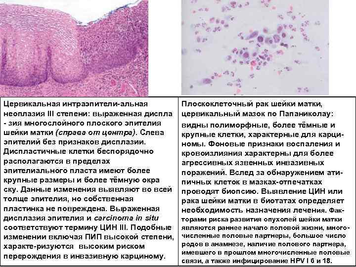 Для клинической картины разрыва шейки матки характерно тест