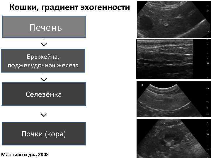 Предстательная железа эхогенность. Эхогенность структуры при УЗИ. Ультразвуковая анатомия поджелудочной железы.
