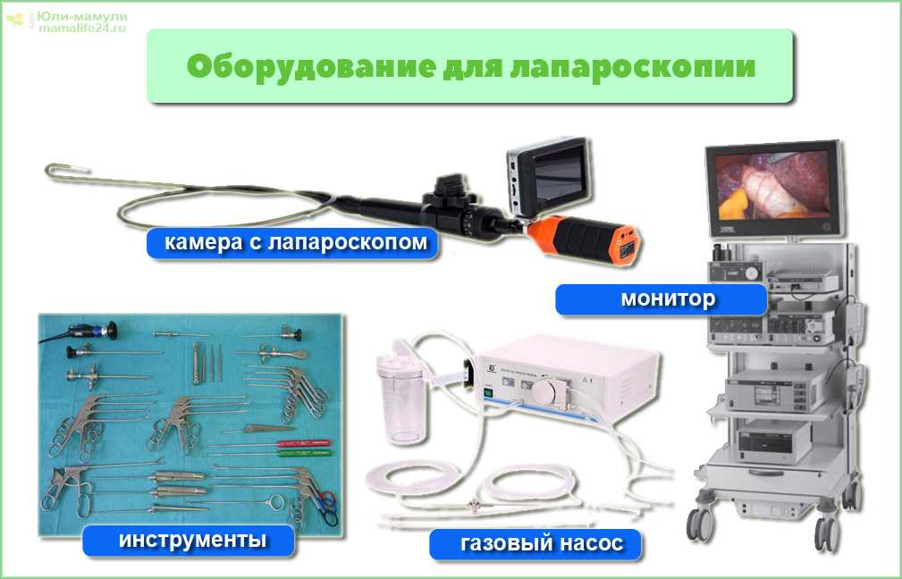 Лапароскопия показания. Инструменты для лапароскопических операций. Аппарат для лапароскопических операций. Оборудование для лапароскопической хирургии.