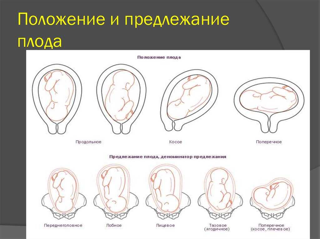 Продольное положение плода | образ жизни для хорошего здоровья