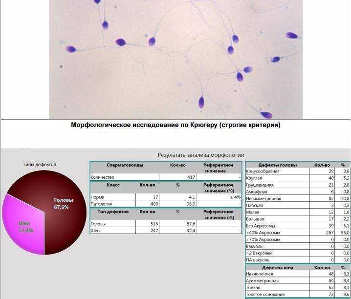 Морфология по крюгеру расшифровка. Нормы анализа спермограммы по Крюгеру. Нормы исследования спермограммы по Крюгеру. Спермограмма морфология по Крюгеру и мар тест. Морфологическое исследование сперматозоидов по Крюгеру.