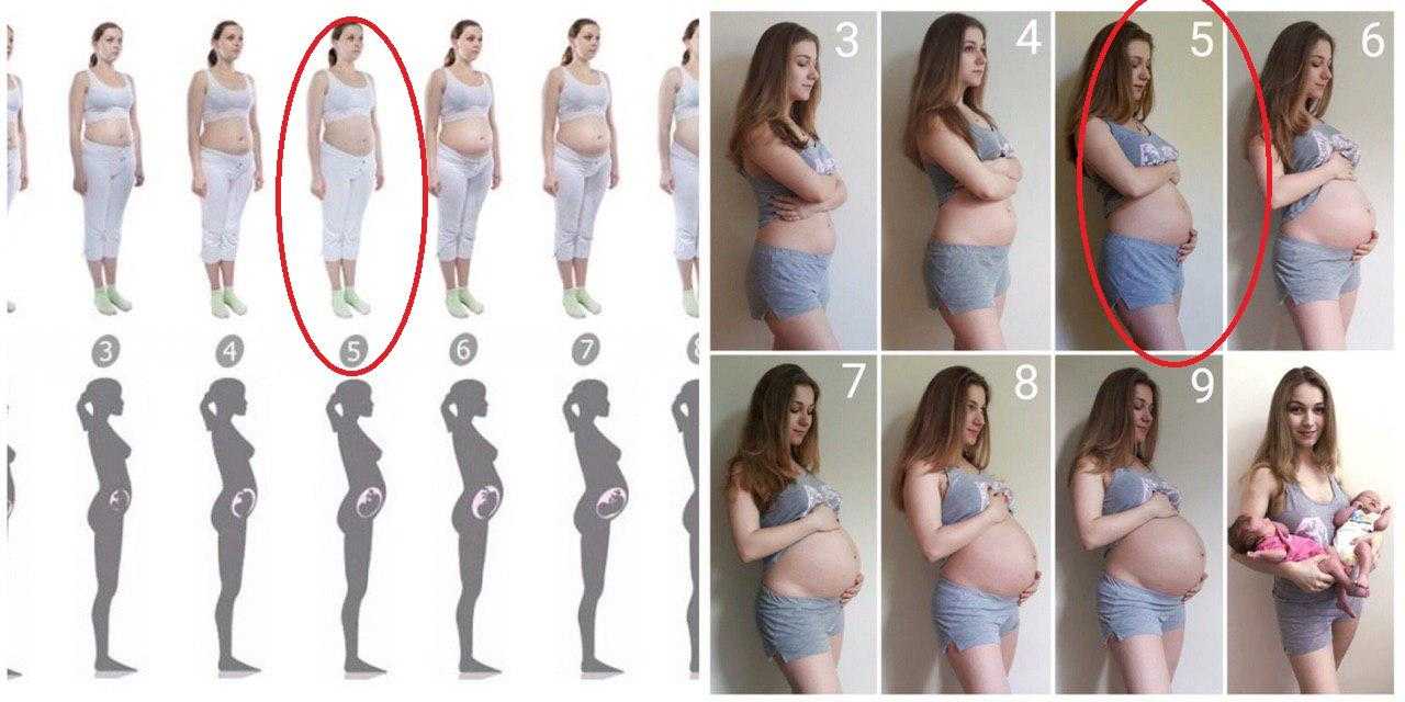 Третья беременность живот растет. Беременность тройней живот по неделям. Живот в 3 месяца при беременности двойней. Живот в 7 месяцев беременности при двойне. Живот с двойней по неделям.