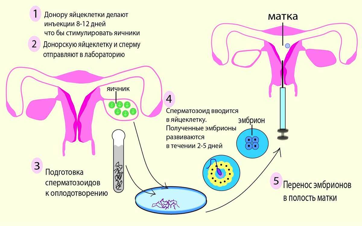 Донор яйцеклетки фото