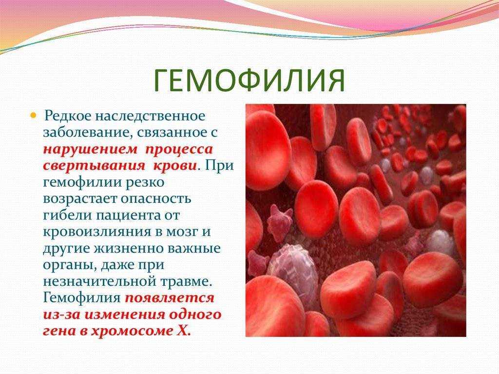 Гемофилия | eurolab | научные статьи