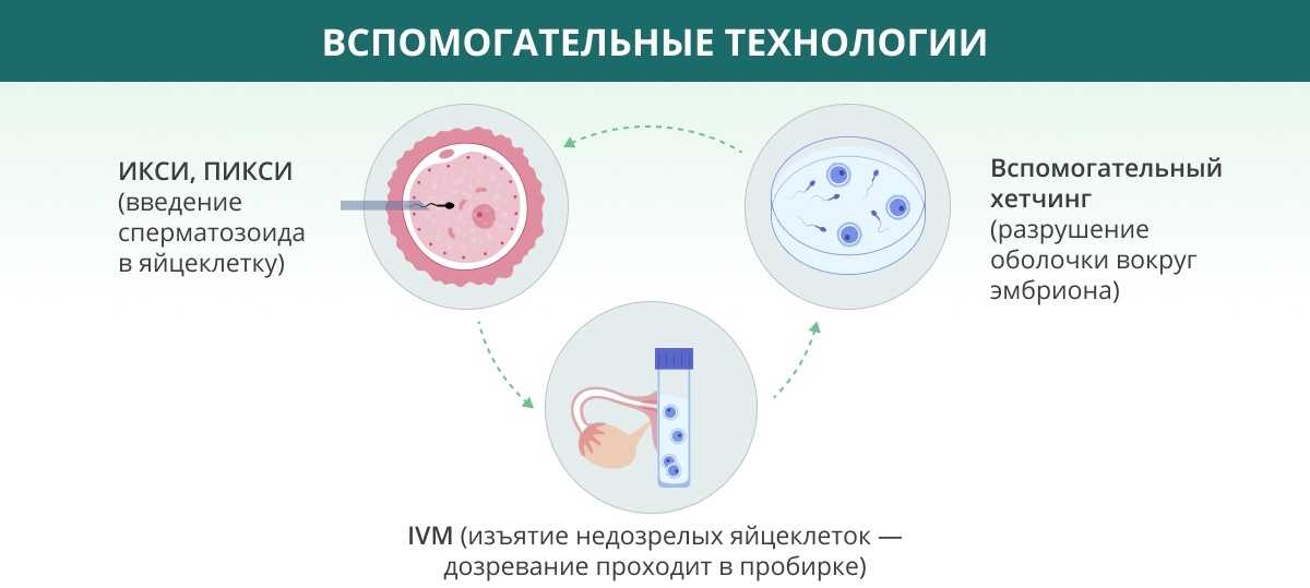 Что такое хетчинг эмбрионов и для какой цели он проводится в процедуре эко?