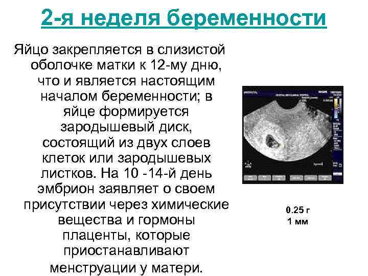 Четвертая неделя беременности