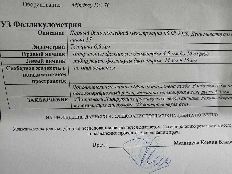 Что такое фолликулометрия: как ее делают, как подготовиться, показатели