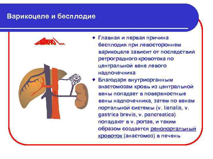 Варикоцеле у мужчин бесплодие