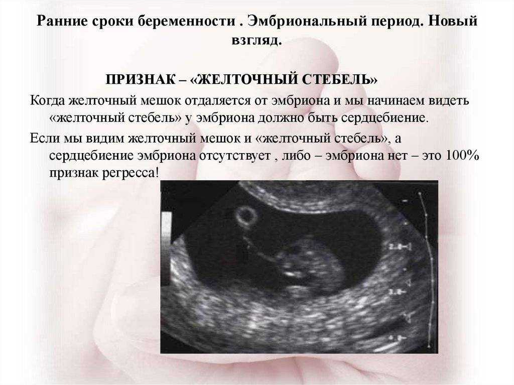 Когда на узи видно плодное яйцо, почему эмбрион не визуализируется на сроке 6–7 недель беременности?