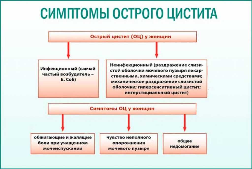 Цистит: что это, причины, лечение, симптомы