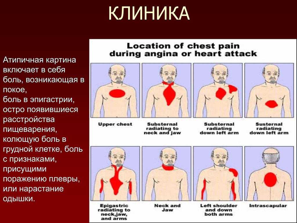 Где находится сердце у человека фото у женщин и как болит симптомы лечение