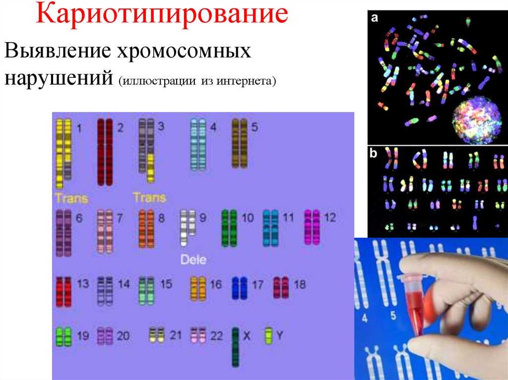 Все пороки плода на узи: таблица развития, расшифровка генетических отклонений * клиника диана в санкт-петербурге