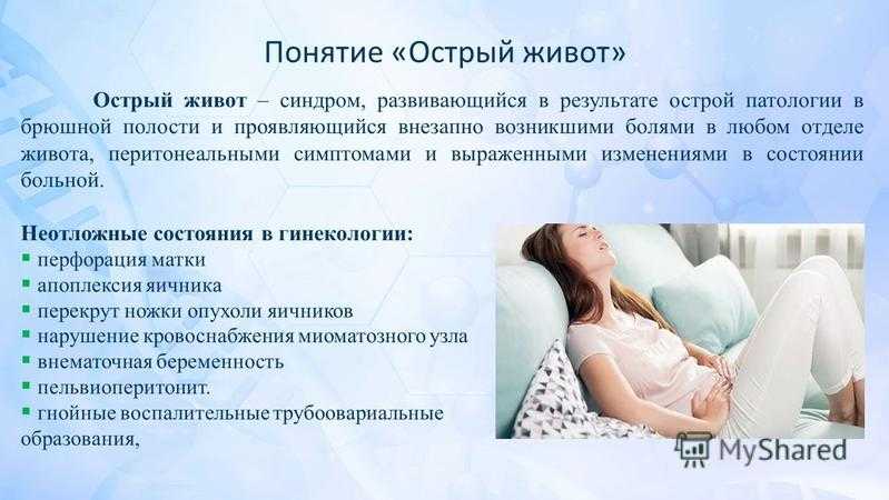 Внематочная беременность