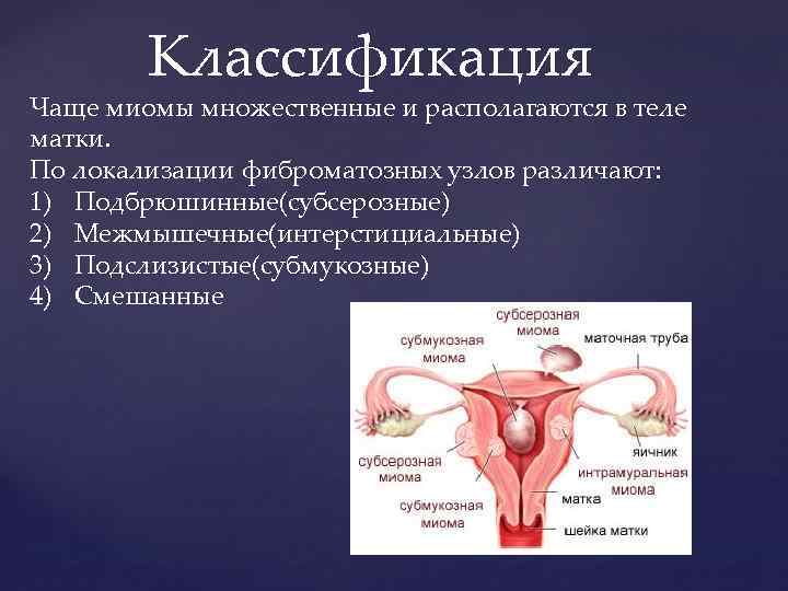 Миома матки симптомы и признаки