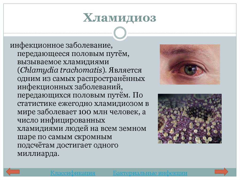 Заболевание вызванное рядом. Хламидийные заболевания глаз. Хламидиоз клинические проявления. Кожные инфекции заболевания. Проявление заболеваний на глазах.