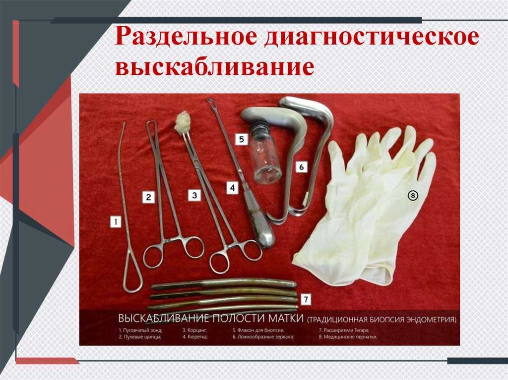 Гинекологическая чистка: где сделать, показания, как подготовиться, осбледование перед гинекологической чисткой, осложнения